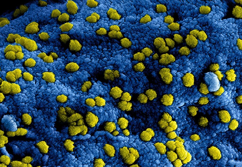 Yellow microorganisms are scattered across a blue background in an electron microscopy image.